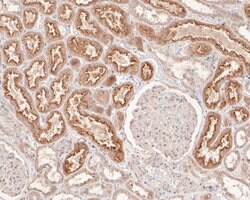 Invitrogen SKI Polyclonal Antibody 100 &mu;L; Unconjugated:Antibodies,