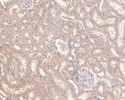 Invitrogen UCRC Polyclonal Antibody 100 &mu;L; Unconjugated:Antibodies,