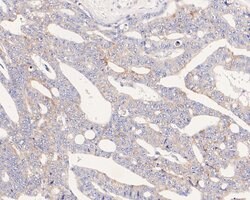 Invitrogen UCRC Polyclonal Antibody 100 &mu;L; Unconjugated:Antibodies,