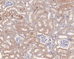 Invitrogen UCRC Polyclonal Antibody 100 &mu;L; Unconjugated:Antibodies,