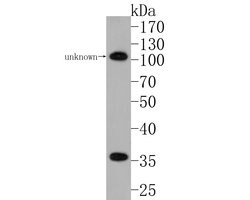 Invitrogen CER1 Polyclonal Antibody 100 &mu;L; Unconjugated:Antibodies,