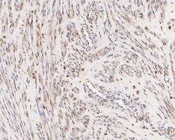 Invitrogen DRAP1 Polyclonal Antibody 100 μL; Unconjugated:Antibodies,