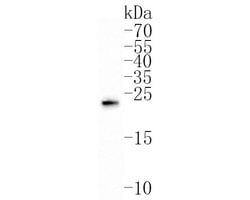 Invitrogen GREM2 Polyclonal Antibody 100 &mu;L; Unconjugated:Antibodies,