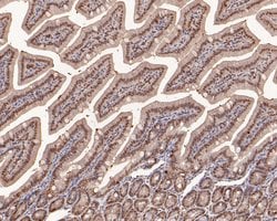 Invitrogen SNW1 Polyclonal Antibody 100 &mu;L; Unconjugated:Antibodies,