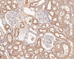 Invitrogen UBE2D1 Polyclonal Antibody 100 &mu;L; Unconjugated:Antibodies,
