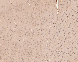 Invitrogen UBE2D3 Polyclonal Antibody 100 &mu;L; Unconjugated:Antibodies,
