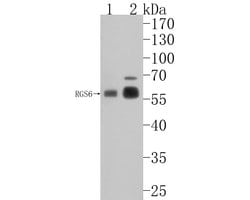 Invitrogen RGS6 Polyclonal Antibody 100 &mu;L; Unconjugated:Antibodies,