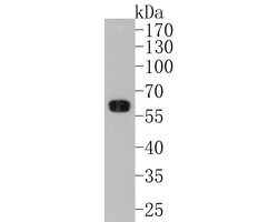 Invitrogen RGS6 Polyclonal Antibody 100 &mu;L; Unconjugated:Antibodies,
