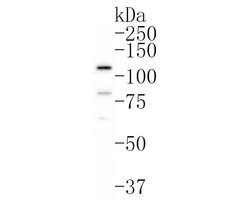 Invitrogen SMG5 Polyclonal Antibody 100 &mu;L; Unconjugated:Antibodies,