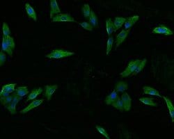Endothelin 3 Polyclonal Antibody, Invitrogen 100 &mu;L; Unconjugated:Antibodies,