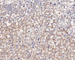 Endothelin 3 Polyclonal Antibody, Invitrogen 100 &mu;L; Unconjugated:Antibodies,