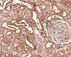 Invitrogen CLCN2 Polyclonal Antibody 100 &mu;L; Unconjugated:Antibodies,