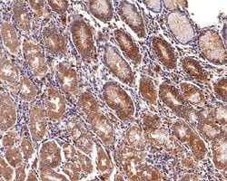 Invitrogen CLCN2 Polyclonal Antibody 100 &mu;L; Unconjugated:Antibodies,