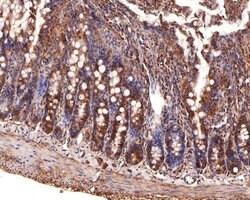 Invitrogen CLCN2 Polyclonal Antibody 100 &mu;L; Unconjugated:Antibodies,