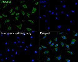 Invitrogen IFNGR2 Polyclonal Antibody 100 &mu;L; Unconjugated:Antibodies,