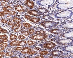 Invitrogen IFNGR2 Polyclonal Antibody 100 &mu;L; Unconjugated:Antibodies,