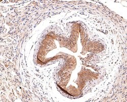 Invitrogen IFNGR2 Polyclonal Antibody 100 &mu;L; Unconjugated:Antibodies,