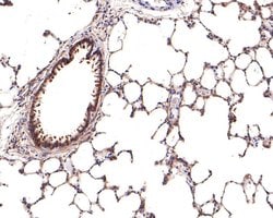 Invitrogen IFNGR2 Polyclonal Antibody 100 &mu;L; Unconjugated:Antibodies,