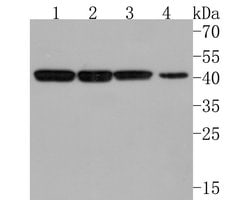 Invitrogen IFNGR2 Polyclonal Antibody 100 &mu;L; Unconjugated:Antibodies,