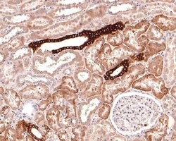 Invitrogen Aquaporin 3 Polyclonal Antibody 100 &mu;L; Unconjugated:Antibodies,