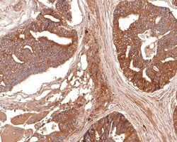 Invitrogen Aquaporin 3 Polyclonal Antibody 100 &mu;L; Unconjugated:Antibodies,
