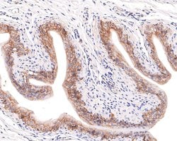 Invitrogen Aquaporin 3 Polyclonal Antibody 100 &mu;L; Unconjugated:Antibodies,