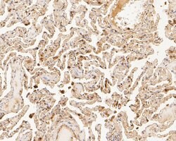 Invitrogen TTK Polyclonal Antibody 100 &mu;L; Unconjugated:Antibodies,