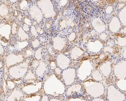 Invitrogen TTK Polyclonal Antibody 100 &mu;L; Unconjugated:Antibodies,