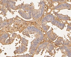 Invitrogen TTK Polyclonal Antibody 100 &mu;L; Unconjugated:Antibodies,