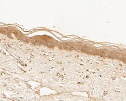 Invitrogen TTK Polyclonal Antibody 100 &mu;L; Unconjugated:Antibodies,