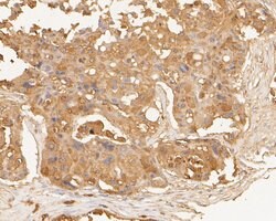 Invitrogen TTK Polyclonal Antibody 100 &mu;L; Unconjugated:Antibodies,