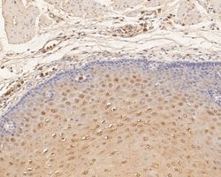 Invitrogen TTK Polyclonal Antibody 100 &mu;L; Unconjugated:Antibodies,