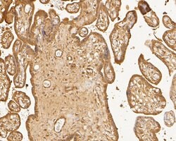 Invitrogen TTK Polyclonal Antibody 100 &mu;L; Unconjugated:Antibodies,