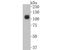 Invitrogen TTK Polyclonal Antibody 100 &mu;L; Unconjugated:Antibodies,