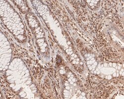 Invitrogen SNRPD3 Polyclonal Antibody 100 &mu;L; Unconjugated:Antibodies,