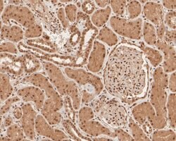 Invitrogen SNRPD3 Polyclonal Antibody 100 &mu;L; Unconjugated:Antibodies,