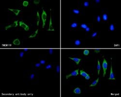 Invitrogen TMEM119 Polyclonal Antibody 100 &mu;L; Unconjugated:Antibodies,