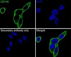 Invitrogen CD116 Polyclonal Antibody 100 &mu;L | Buy Online | Invitrogen&trade; | Fisher Scientific