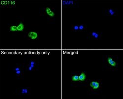 Invitrogen CD116 Polyclonal Antibody 100 &mu;L | Buy Online | Invitrogen&trade; | Fisher Scientific