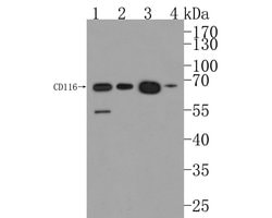 Invitrogen CD116 Polyclonal Antibody 100 &mu;L | Buy Online | Invitrogen&trade; | Fisher Scientific
