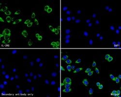 Invitrogen IL2RG Polyclonal Antibody 100 &mu;L | Buy Online | Invitrogen&trade; | Fisher Scientific