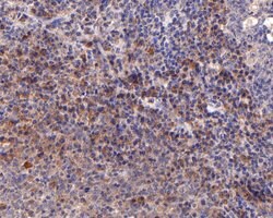 Invitrogen IL2RG Polyclonal Antibody 100 &mu;L | Buy Online | Invitrogen&trade; | Fisher Scientific
