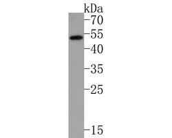 Invitrogen IL2RG Polyclonal Antibody 100 &mu;L | Buy Online | Invitrogen&trade; | Fisher Scientific