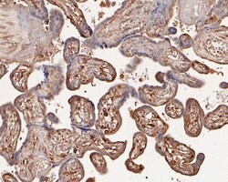 Invitrogen Activin A Polyclonal Antibody 100 &mu;L; Unconjugated:Antibodies,