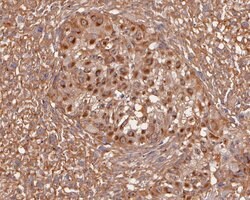 Invitrogen Activin A Polyclonal Antibody 100 &mu;L; Unconjugated:Antibodies,