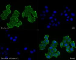 Invitrogen SLC25A37 Polyclonal Antibody 100 &mu;L; Unconjugated:Antibodies,