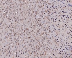 Invitrogen SLC25A37 Polyclonal Antibody 100 &mu;L; Unconjugated:Antibodies,