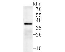 Invitrogen SLC25A37 Polyclonal Antibody 100 &mu;L; Unconjugated:Antibodies,