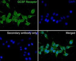 Invitrogen CSF3R Polyclonal Antibody 100 &mu;L; Unconjugated:Antibodies,