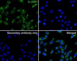 Invitrogen IL20RA Polyclonal Antibody 100 &mu;L; Unconjugated:Antibodies,
